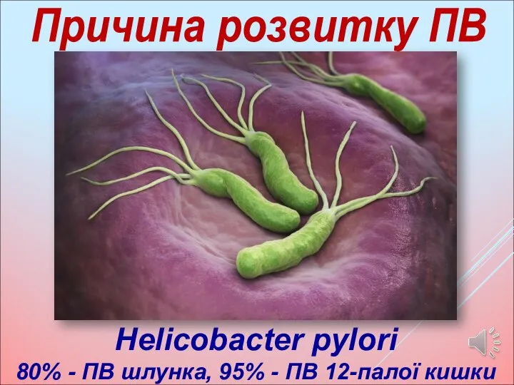 Причина розвитку ПВ Helicobacter pylori 80% - ПВ шлунка, 95% - ПВ 12-палої кишки