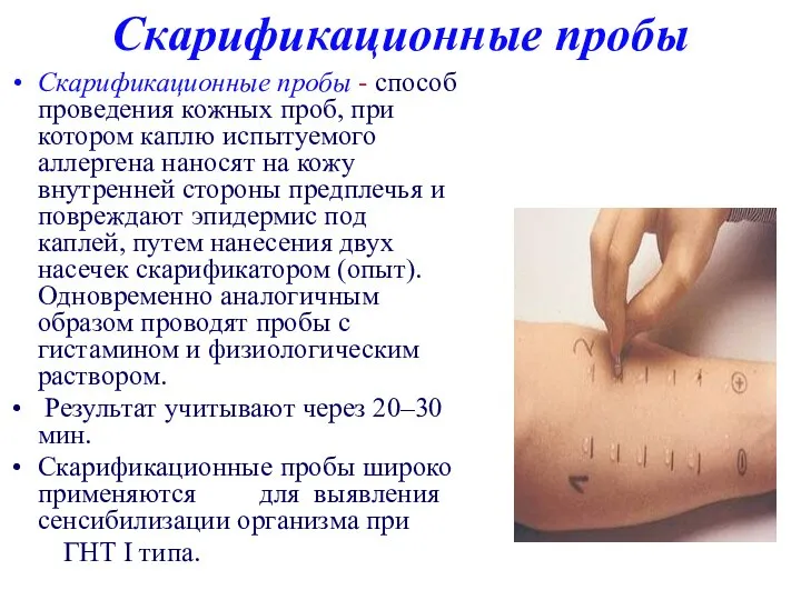 Скарификационные пробы Скарификационные пробы - способ проведения кожных проб, при котором каплю