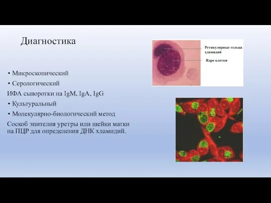 Диагностика Микроскопический Серологический ИФА сыворотки на IgM, IgA, IgG Культуральный Молекулярно-биологический метод