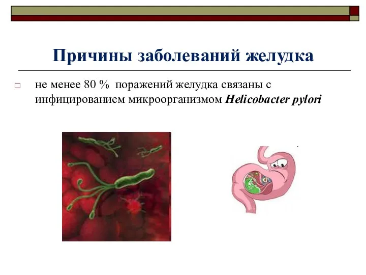 не менее 80 % поражений желудка связаны с инфицированием микроорганизмом Helicobacter pylori Причины заболеваний желудка