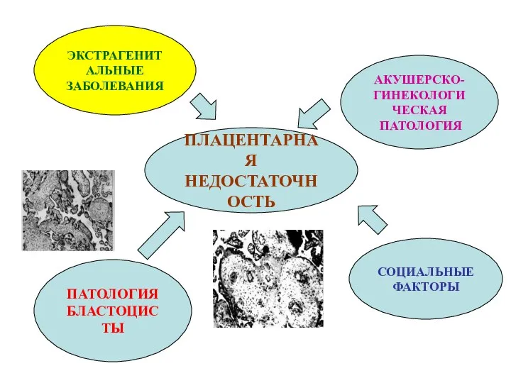 ПЛАЦЕНТАРНАЯ НЕДОСТАТОЧНОСТЬ ЭКСТРАГЕНИТАЛЬНЫЕ ЗАБОЛЕВАНИЯ АКУШЕРСКО- ГИНЕКОЛОГИЧЕСКАЯ ПАТОЛОГИЯ ПАТОЛОГИЯ БЛАСТОЦИСТЫ СОЦИАЛЬНЫЕ ФАКТОРЫ