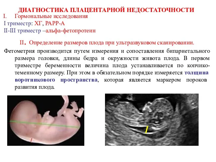 ДИАГНОСТИКА ПЛАЦЕНТАРНОЙ НЕДОСТАТОЧНОСТИ Гормональные исследования I триместр: ХГ, РАРР-А II-III триместр –альфа-фетопротеин