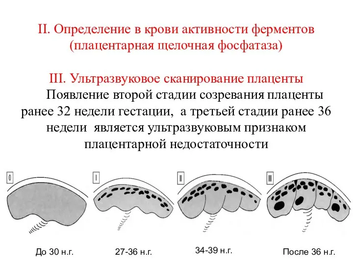 II. Определение в крови активности ферментов (плацентарная щелочная фосфатаза) III. Ультразвуковое сканирование