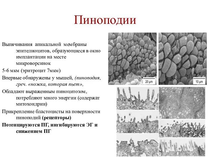 Пиноподии Выпячивания апикальной мембраны эпителиоцитов, образующиеся в окно имплантации на месте микроворсинок