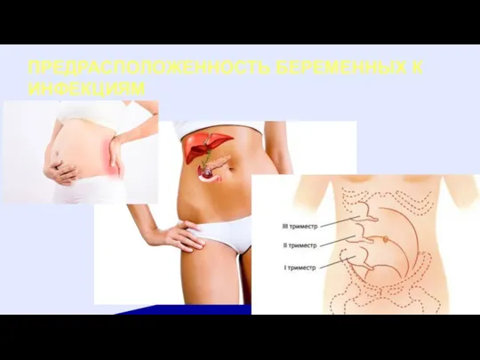 ПРЕДРАСПОЛОЖЕННОСТЬ БЕРЕМЕННЫХ К ИНФЕКЦИЯМ