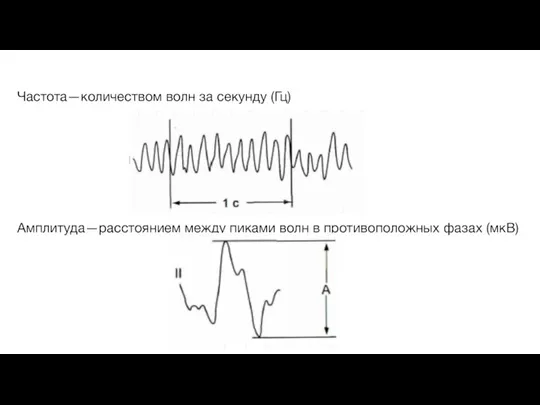 Частота—количеством волн за секунду (Гц) Амплитуда—расстоянием между пиками волн в противоположных фазах (мкВ)