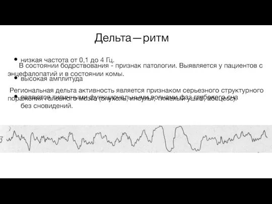 Дельта—ритм низкая частота от 0,1 до 4 Гц. высокая амплитуда являются типичными