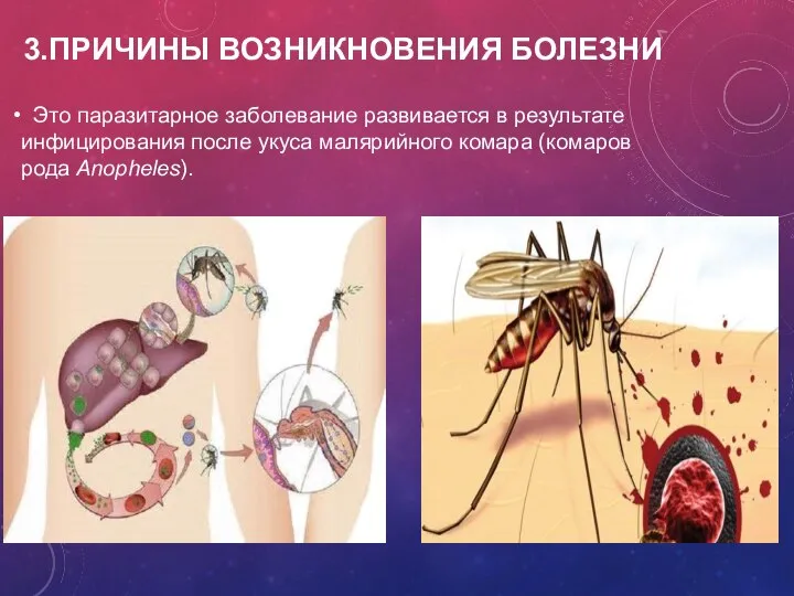 3.ПРИЧИНЫ ВОЗНИКНОВЕНИЯ БОЛЕЗНИ Это паразитарное заболевание развивается в результате инфицирования после укуса