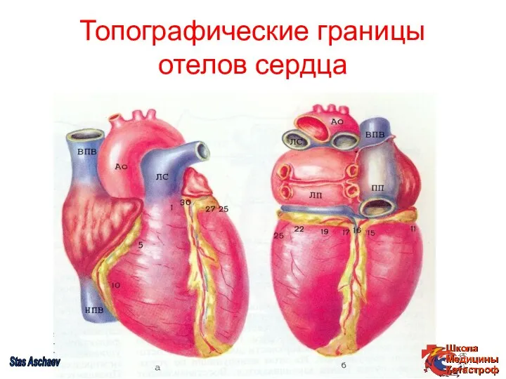 Топографические границы отелов сердца Stas Aschaev