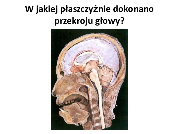 W jakiej płaszczyźnie dokonano przekroju głowy?