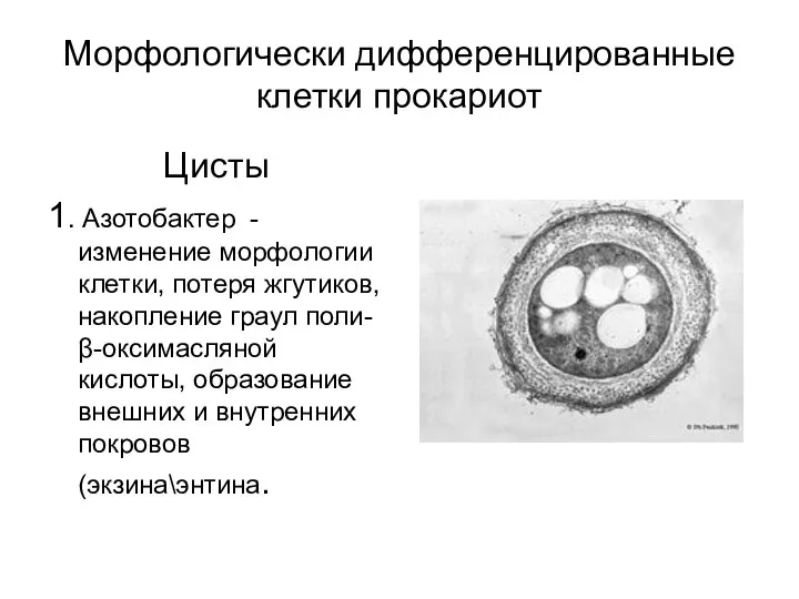 Морфологически дифференцированные клетки прокариот Цисты 1. Азотобактер - изменение морфологии клетки, потеря