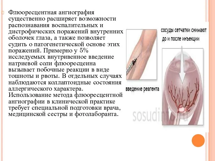 Флюоресцентная ангиография существенно расширяет возможности распознавания воспалительных и дистрофических поражений внутренних оболочек