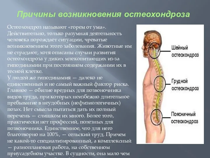 Причины возникновения остеохондроза Остеохондроз называют «горем от ума». Действительно, только разумная деятельность