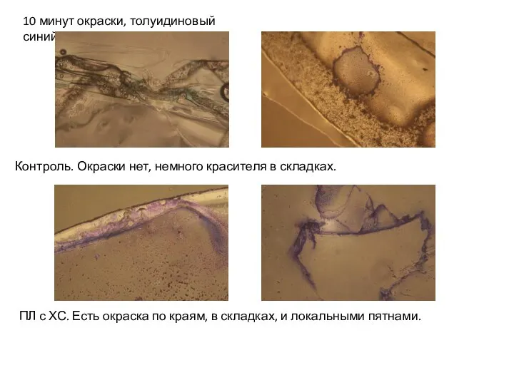 10 минут окраски, толуидиновый синий Контроль. Окраски нет, немного красителя в складках.