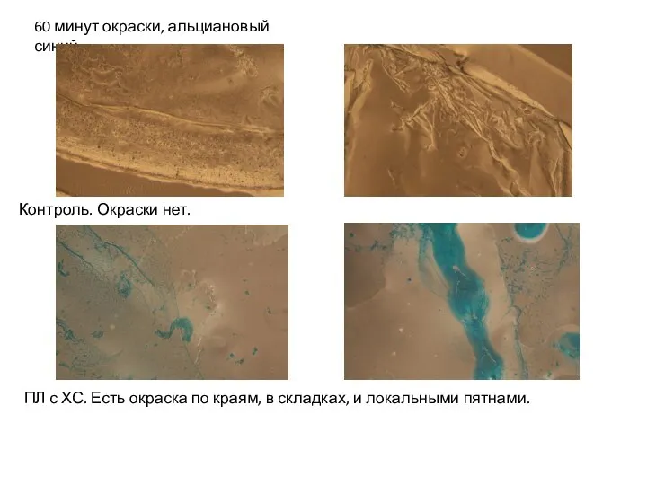 60 минут окраски, альциановый синий Контроль. Окраски нет. ПЛ с ХС. Есть