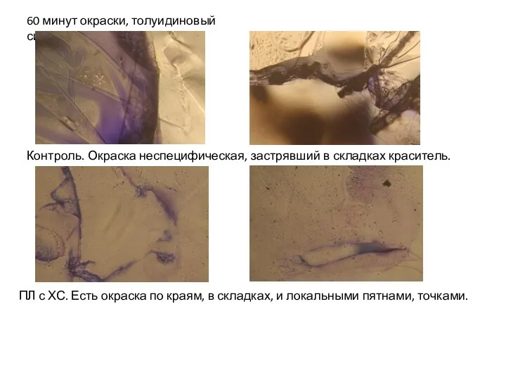 60 минут окраски, толуидиновый синий Контроль. Окраска неспецифическая, застрявший в складках краситель.