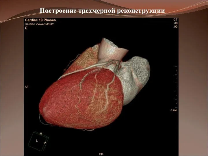 Построение трехмерной реконструкции