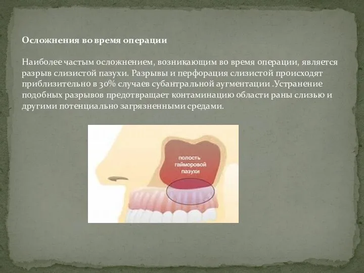 Осложнения во время операции Наиболее частым осложнением, возникающим во время операции, является