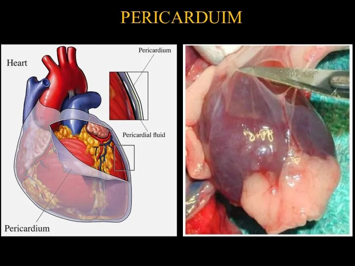 PERICARDUIM