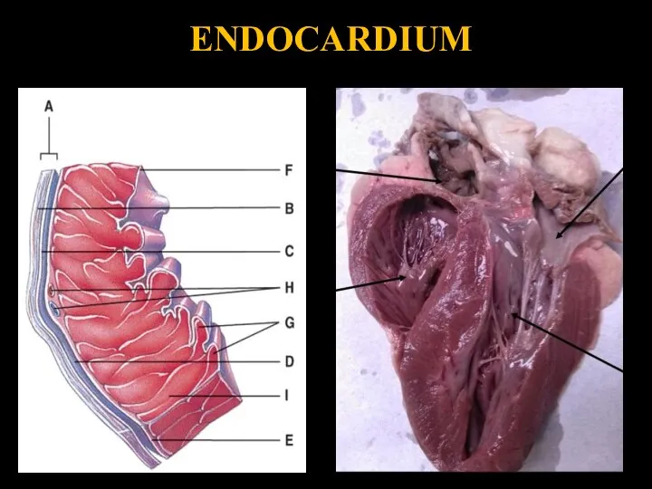 ENDOCARDIUM