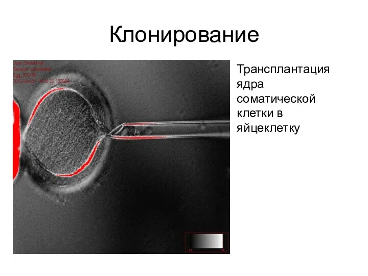 Клонирование Трансплантация ядра соматической клетки в яйцеклетку