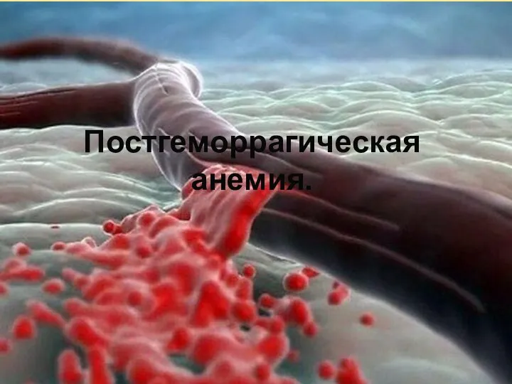 Постгеморрагическая анемия.