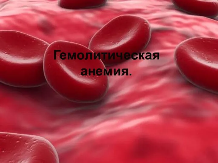 Гемолитическая анемия.
