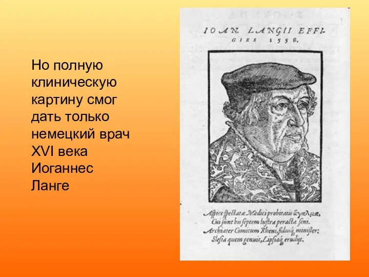 Но полную клиническую картину смог дать только немецкий врач XVI века Иоганнес Ланге