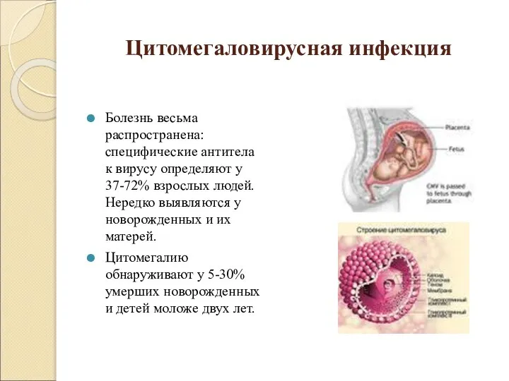 Цитомегаловирусная инфекция Болезнь весьма распространена: специфические антитела к вирусу определяют у 37-72%