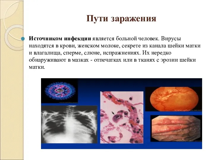 Пути заражения Источником инфекции является больной человек. Вирусы находятся в крови, женском