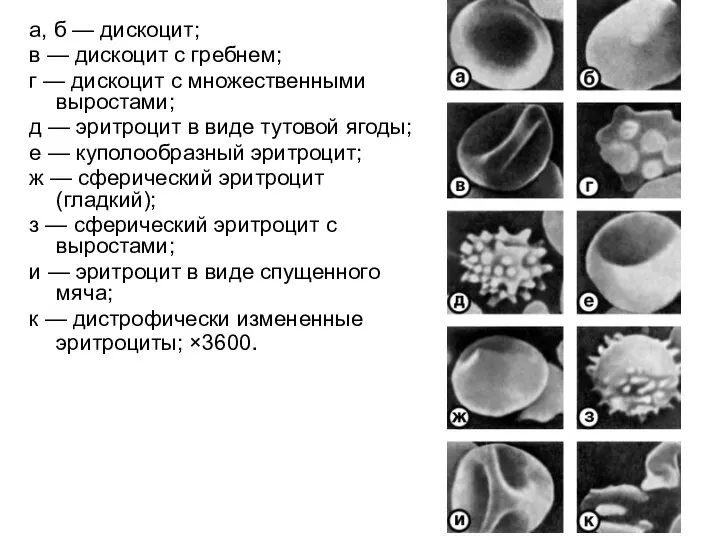 а, б — дискоцит; в — дискоцит с гребнем; г — дискоцит