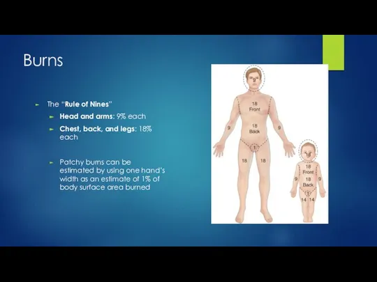 Burns The “Rule of Nines” Head and arms: 9% each Chest, back,