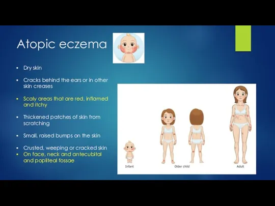 Atopic eczema Dry skin Cracks behind the ears or in other skin