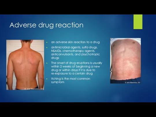 Adverse drug reaction an adverse skin reaction to a drug antimicrobial agents,