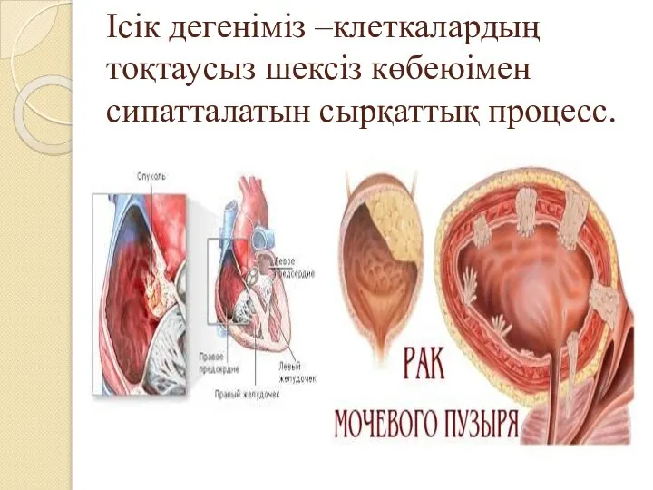 Ісік дегеніміз –клеткалардың тоқтаусыз шексіз көбеюімен сипатталатын сырқаттық процесс.