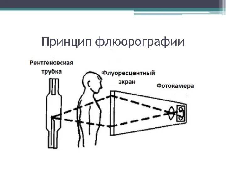 Принцип флюорографии