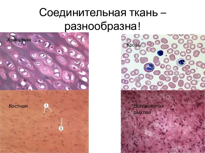 Соединительная ткань – разнообразна! Хрящевая Костная Кровь Волокнистая рыхлая