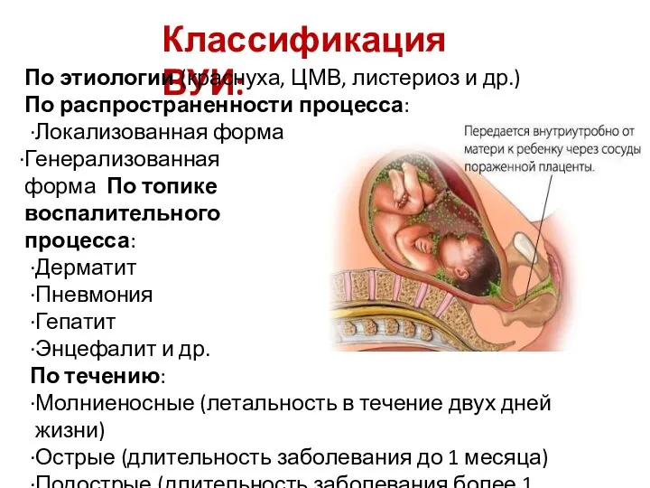 Классификация ВУИ: По этиологии (краснуха, ЦМВ, листериоз и др.) По распространенности процесса: