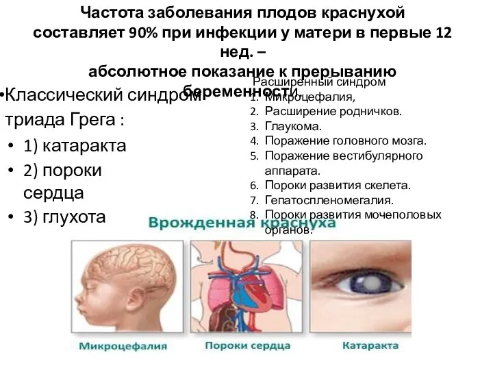 Классический синдром триада Грега : 1) катаракта 2) пороки сердца 3) глухота