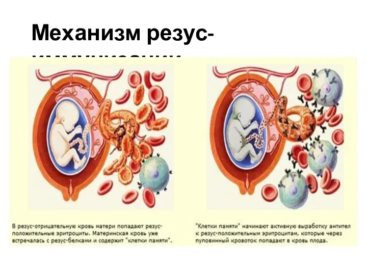 Механизм резус-иммунизации