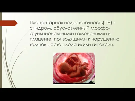 Плацентарная недостаточность(ПН) -синдром, обусловленный морфо-функциональными изменениями в плаценте, приводящими к нарушению темпов роста плода и/или гипоксии.