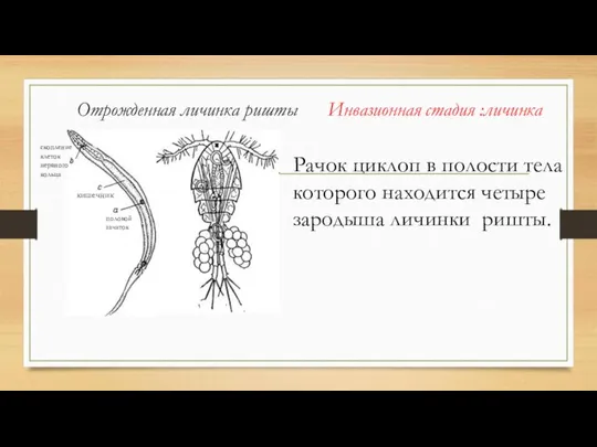 Отрожденная личинка ришты Инвазионная стадия :личинка кишечник скопление клеток нервного кольца половой