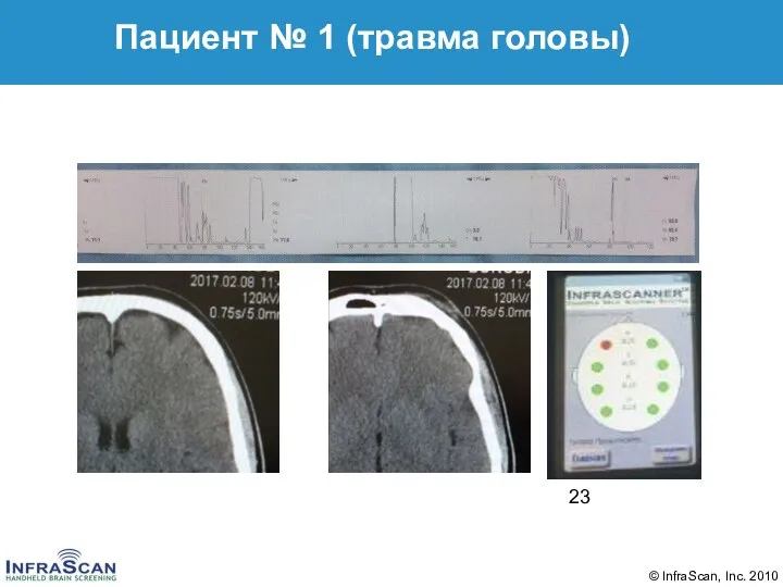 Пациент № 1 (травма головы)