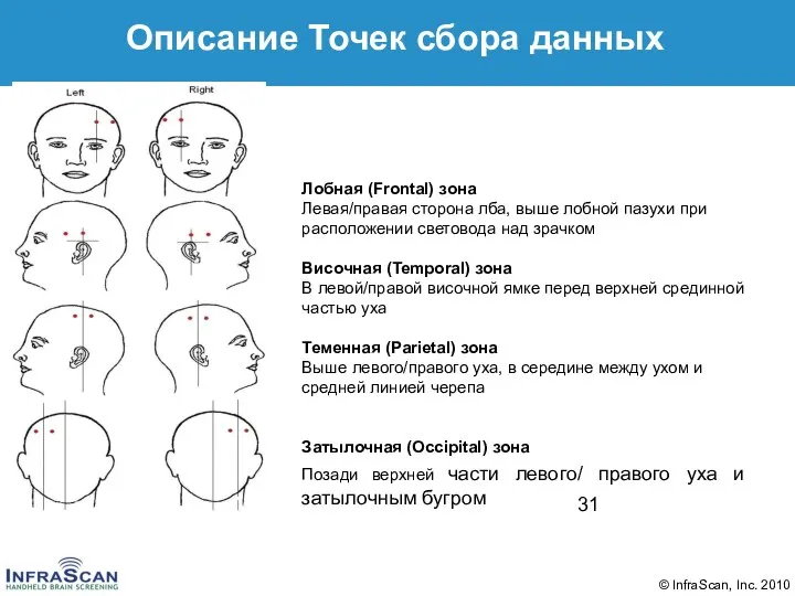 Описание Точек сбора данных Лобная (Frontal) зона Левая/правая сторона лба, выше лобной