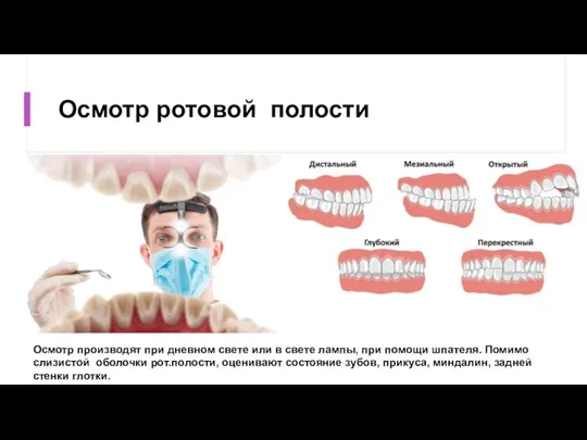 Осмотр ротовой полости Осмотр производят при дневном свете или в свете лампы,