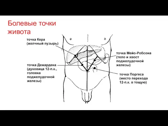 Болевые точки живота