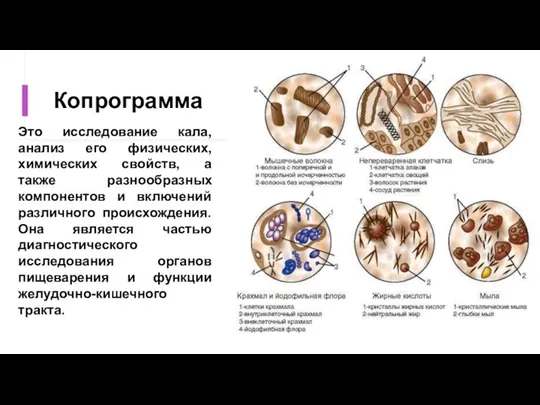 Копрограмма Это исследование кала, анализ его физических, химических свойств, а также разнообразных