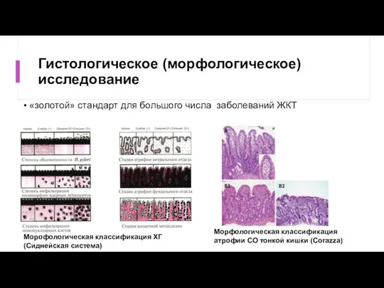 Гистологическое (морфологическое) исследование «золотой» стандарт для большого числа заболеваний ЖКТ Морофологическая классификация