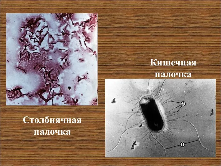 Столбнячная палочка Кишечная палочка