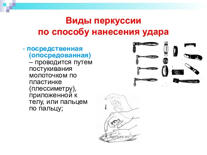 Виды перкуссии по способу нанесения удара - посредственная (опосредованная) – проводится путем